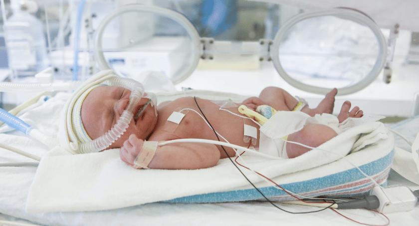 Respiratory disease in the ICU and NICU
